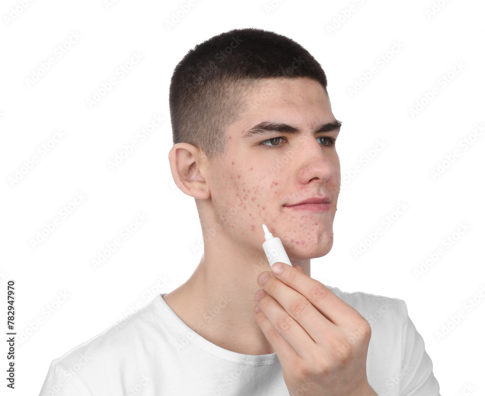 Young man with acne problem applying cosmetic product onto his skin on white background Young man with acne problem applying cosmetic product onto his skin on white background