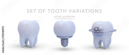 Set of realistic tooth variations isolated on white background. Vector illustration