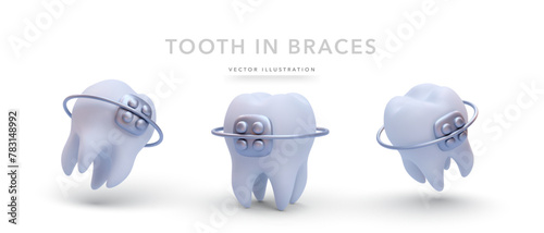 Set of various realistic teeth in style isolated on white background. Vector illustration
