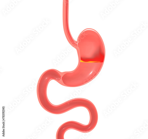 Anatomical 3D illustration of stomach with heartburn and reflux. With fire and moving flames inside. Cut out on white background.
