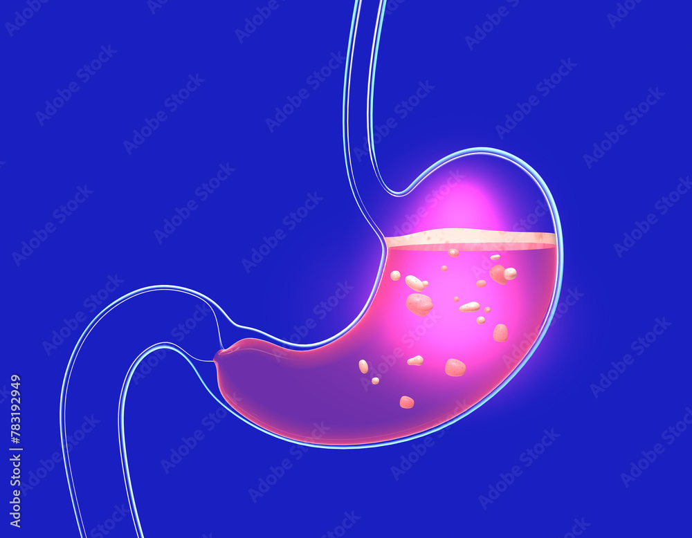 3D illustration of stomach digesting with burning and heaviness. Showing the interior with food. Anatomy of transparent glass with lights and reflections. 3D illustration of stomach digesting with burning and heaviness. Showing the interior with food. Anatomy of transparent glass with lights and reflections.