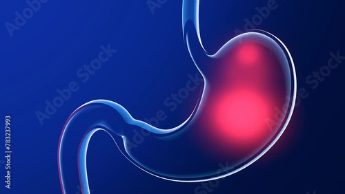 3D animation of stomach with burning. Anatomical cut of transparent glass with lights and reflections on a dark blue background.
 photo