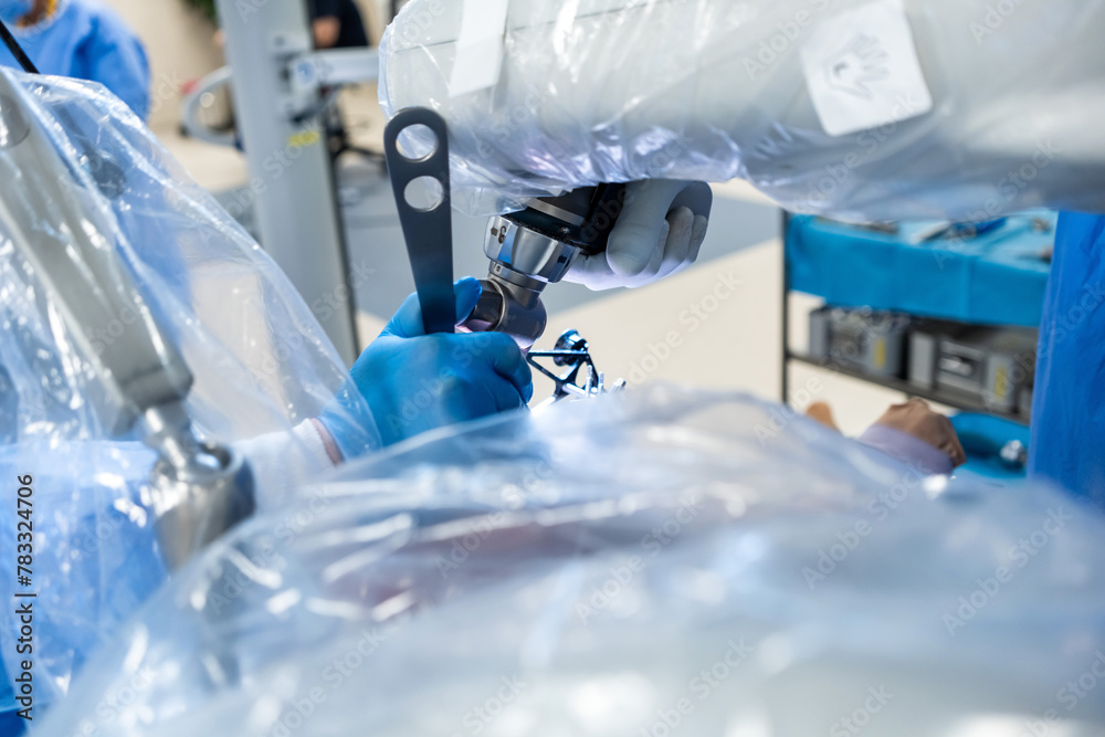 Team of doctor perform total hip arthroplasty replacement surgery in osteoarthritis patient