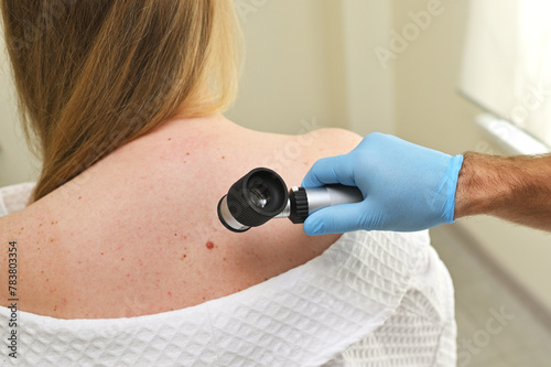 dermatologist oncologist uses a dermatoscope to examine moles and birthmarks on the patient's body. Melanoma Day, Skin Cancer