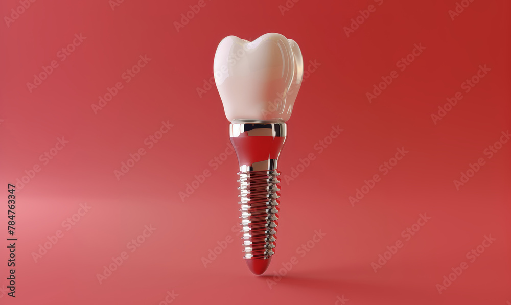 Model of Dental implants with a pin on a red background. Medicine concept, World Oral Health Day Model of Dental implants with a pin on a red background. Medicine concept, World Oral Health Day