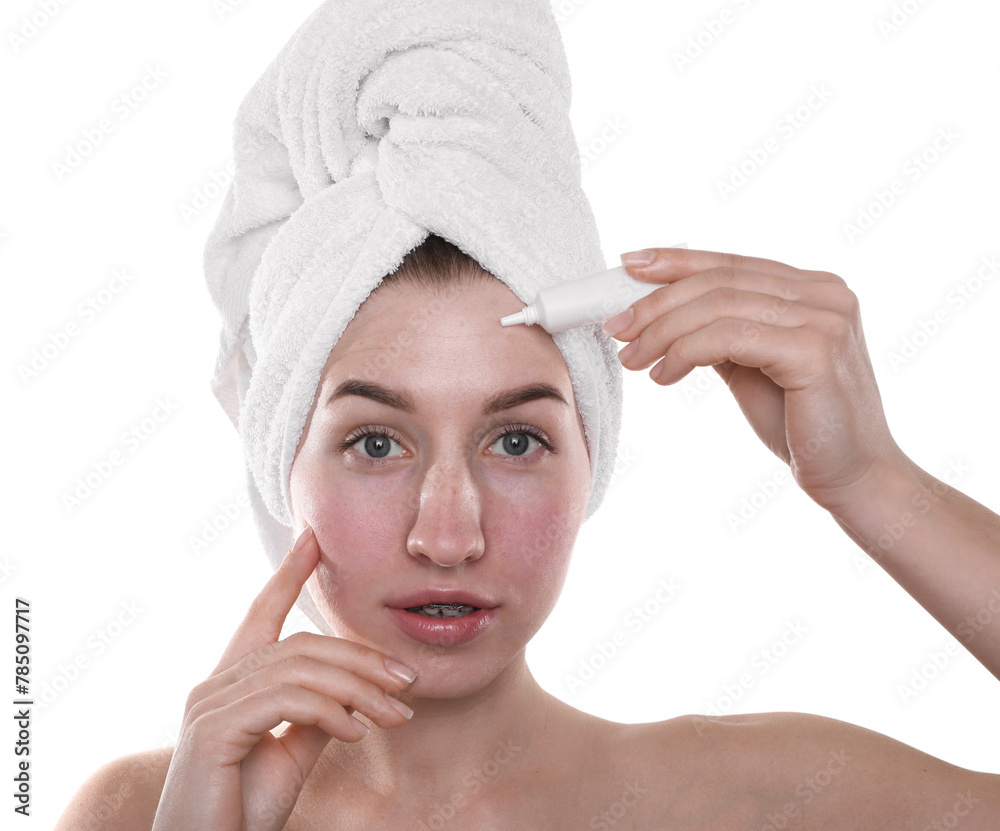 Young woman with acne problem applying cosmetic product onto her skin on white background
