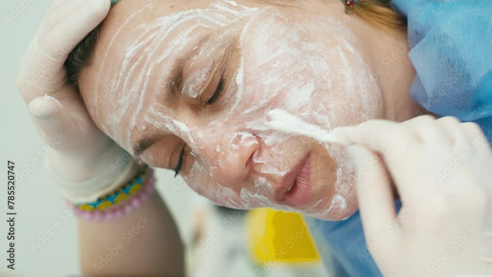 Close-up of application of anesthesia cream on the face. Cosmetic procedures for skin tightening and facial care. High quality 4k footage Close-up of application of anesthesia cream on the face. Cosmetic procedures for skin tightening and facial care. High quality 4k footage