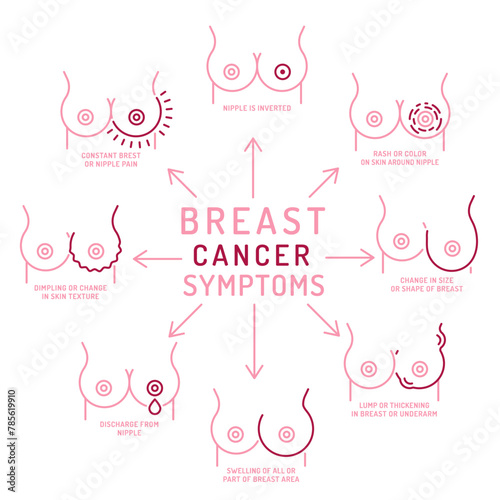 Breast carcinoma, adenocarcinoma symptoms. Malignant breast growth signs.