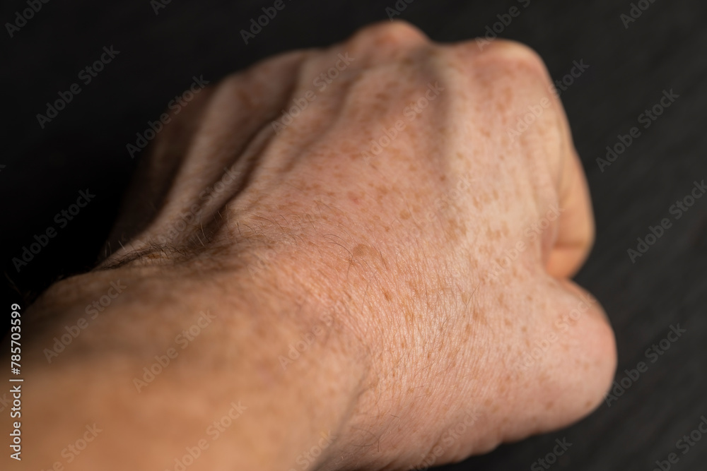 part of a man's hand with freckles part of a man's hand with freckles