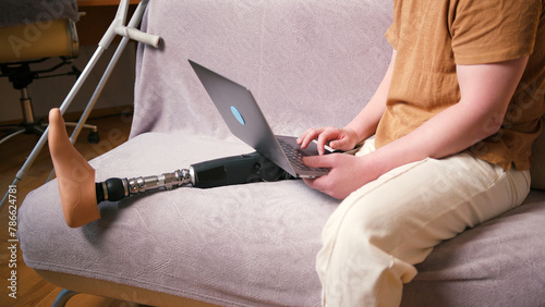 Man amputee with prosthetic leg disability on above knee transfemoral leg prosthesis artificial device using laptop at home. People with amputation disabilities everyday life photo