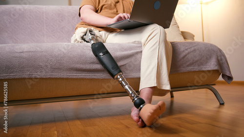 Man amputee with prosthetic leg disability on above knee transfemoral leg prosthesis artificial device using laptop at home. People with amputation disabilities everyday life