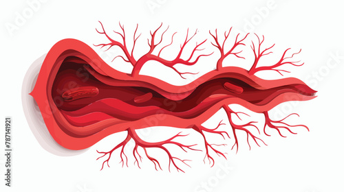 Blood clot thrombus in vein or artery vector Illustration