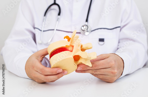 A doctor neurologist holds in his hands a model of the spine against the background of a medical gown. Concept for the treatment of osteochondrosis and scoliosis of the spine, close-up photo