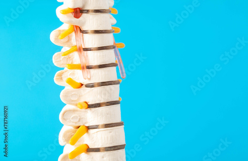 Mockup of the cervical spine on a blue background. The concept of health and treatment of spinal diseases, osteochondrosis and intervertebral disc herniation. Copy space for text, spondylolisthesis photo