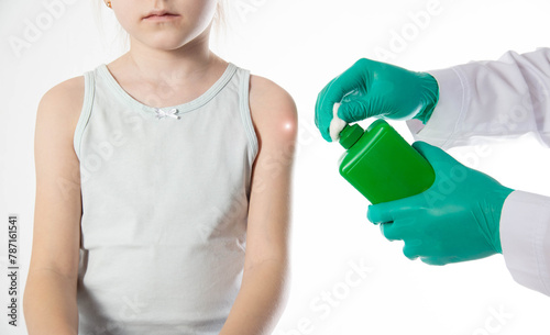 Doctor's hands with cotton wool and antiseptic treating the skin before vaccination against tetanus and viral hepatitis. Revaccination of children, hemophilus influenzae infection photo