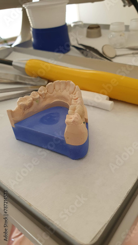 Kieferabdruck für Zahnprothese: Dentales 3D-Modell