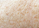 human skin texture with hairs and small pigment spots close-up