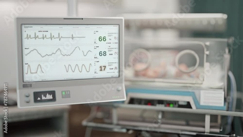 Medical device tracks the heart rhythm of an infected newborn baby patient. Medical device shows the quick worsening of a child heart rhythm. Medical heart rhythm device alarms the doctors. photo