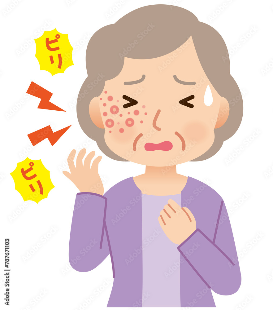 帯状疱疹ができて痛みがある高齢者女性　症状