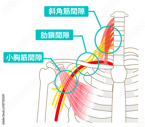 胸郭出口症候群を引き起こす3つの間隙 photo