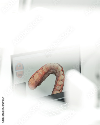 Digital 3D model of patient's jaw on monitor of intraoral scanner. Creation of digital impressions of teeth by dentist. 3D scanning of oral cavity. White background. Soft focus.
