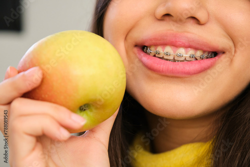 Close up of a smiling female teenager with braces mouth and an apple. © Ladanifer