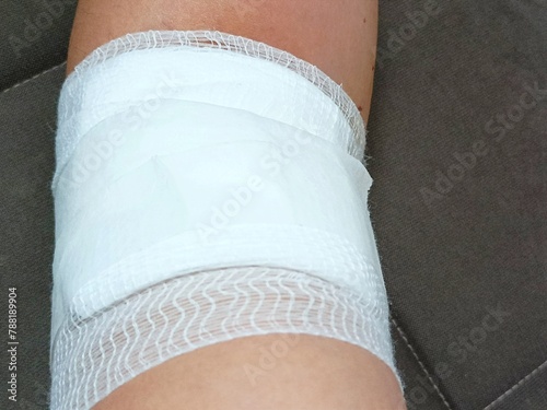Bandage on injured arm