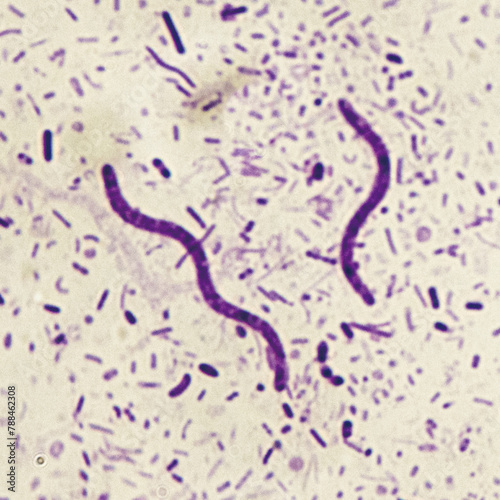 Crimson red spirochetes is a spiral shaped bacterium that is Gram negative and generally undergoes anaerobic phototrophic living.Magnify 1000x
