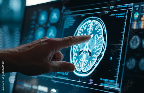 A person is pointing at a brain scan on a computer monitor. The image is in black and white and he is a medical scan.