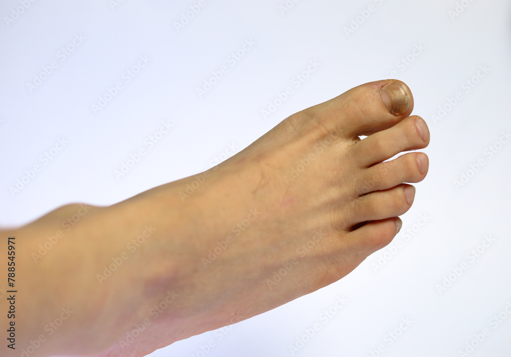 human foot closeup , isolated white background human foot closeup , isolated white background