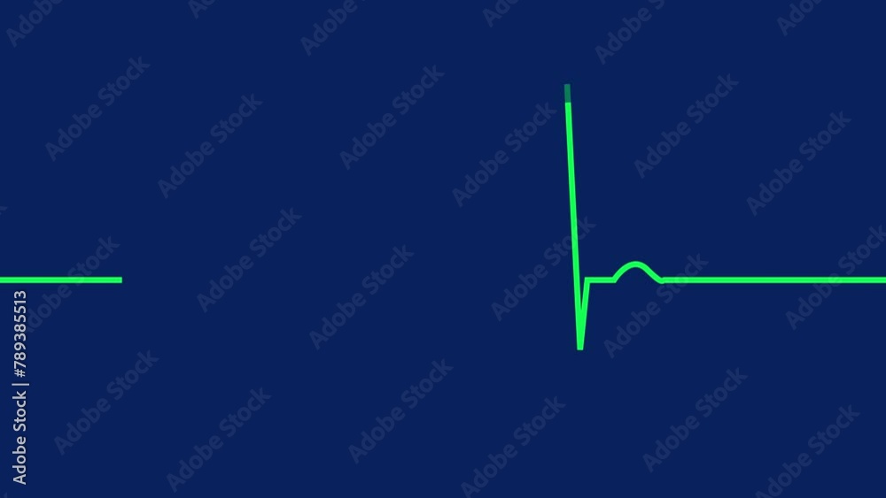 Heart Beat Line light , Heart Beat EKG Monitor Animation, cardiogram ...