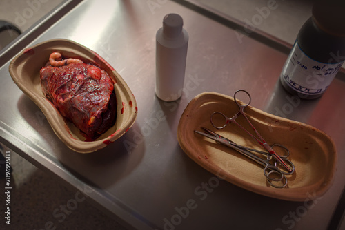 A fresh human placenta rests in its designated medical container, a vital organ of nourishment and oxygenation during pregnancy.
