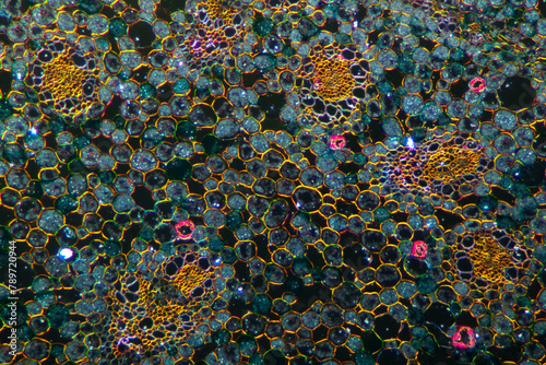 grassleaf sweelflag rhizome (Acorus gramineus) plant cells micrograph