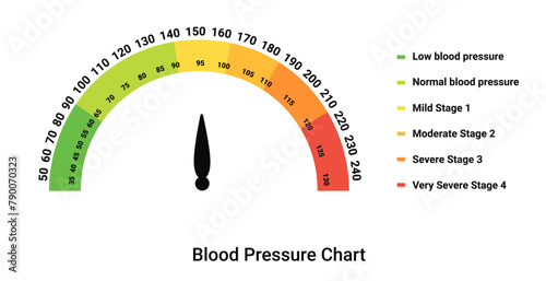 Blood pressure chart. Color scale with arrow and diagram indicators of hypo and hypertension with graphic infographics of cardio vector measurement