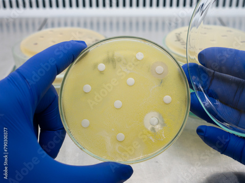 Cuadro en lienzo Round disks with antibiotics are placed in a Petri dish where Escherichia coli grows