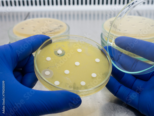 Antibiotic test for the growth of Escherichia coli on a nutrient medium in a Petri dish.