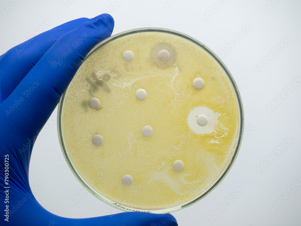 Φωτογραφία The growth of bacteria on a nutrient medium in a petri dish, round disks with antibiotics slow down the growth of bacteria