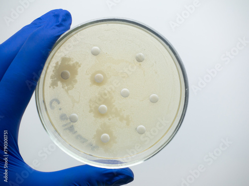 A petri dish in the hand of a scientist and with disks of antibiotics, a study of the effect of antibiotics on bacteria. photo