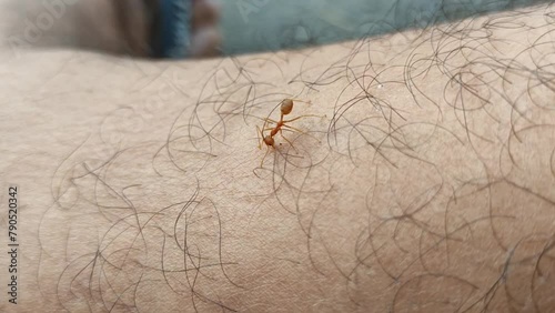 Red ants biting a man's leg photo