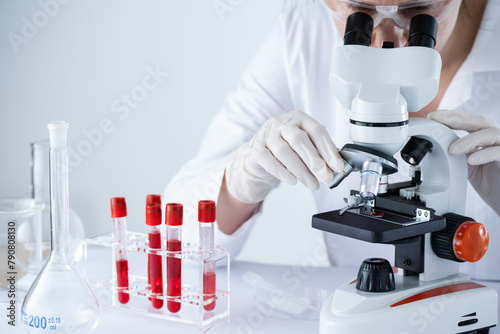 A woman is looking through a microscope at a slide with red blood cells. Test tubes with blood in laboratory. Blood HIV test.