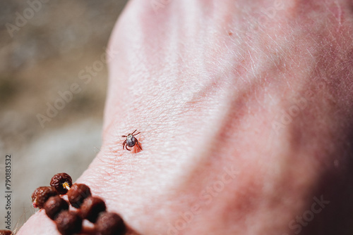 The tick crawls on the skin, looking for a place to bite, a dangerous insect, a carrier of Berlioz's infection and encephalitis. photo