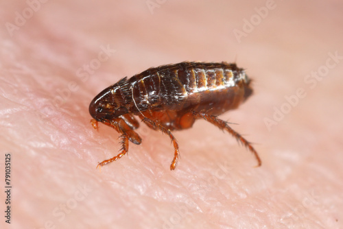 The flea feeds on human skin. Painful flea bite.