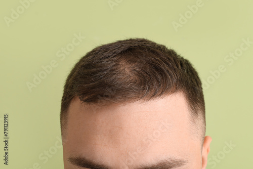 Young man with hair loss problem on green background, closeup