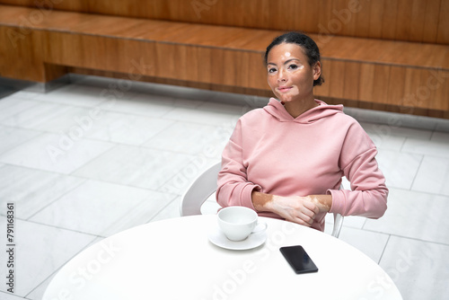 Black african american woman with vitiligo pigmentation skin problem indoor dressed pink hoodie sitting table using smartphone high angle view looking at camera smile