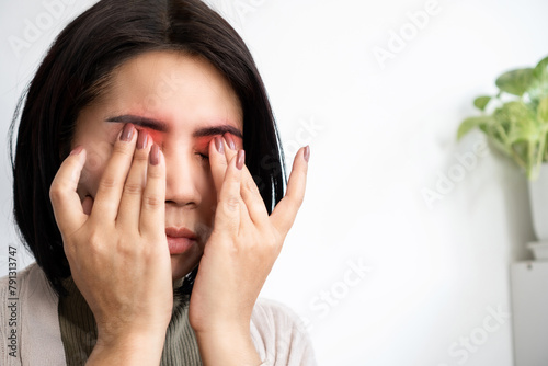 Asian woman suffering from eye pain feeling burning and discomfort , eyestrain concept