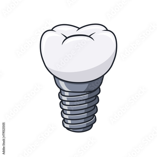 Dental implant of human tooth vector isolated on white background.