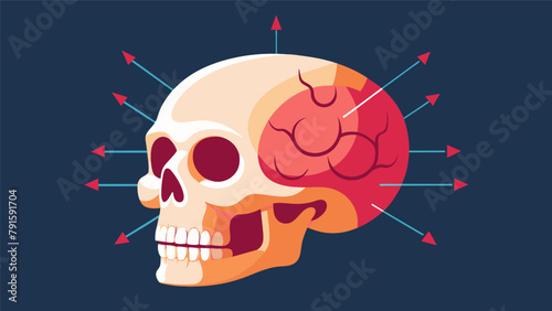A detailed diagram of the skull emphasizing the potential damage that can be done to the brain in a knockout situation.