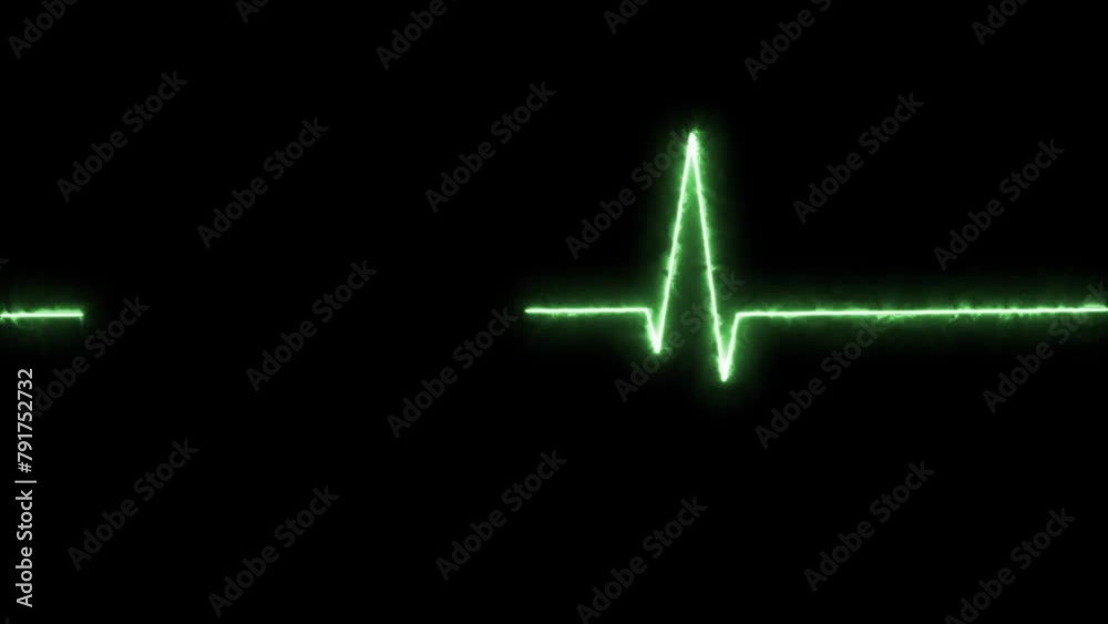 Heartbeat Monitor Animated Video, Heartbeat Medical Cardiogram ...