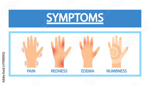 Fototapeta Naklejka Na Ścianę i Meble -  Arthritis Symptoms. Sick Hands With Joint Pain, Redness, Edema Or Numbness. Medical Infographic Poster