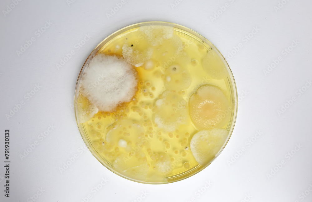 Mould test petri dish culture medium with spore colonies for measuring mold contamination in the air indoors on white background Mould test petri dish culture medium with spore colonies for measuring mold contamination in the air indoors on white background